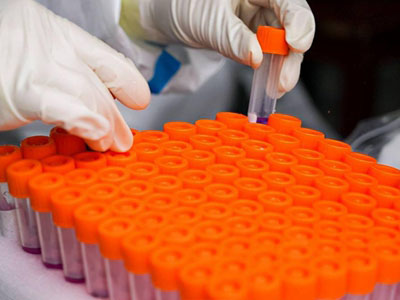 Biospecimen Management